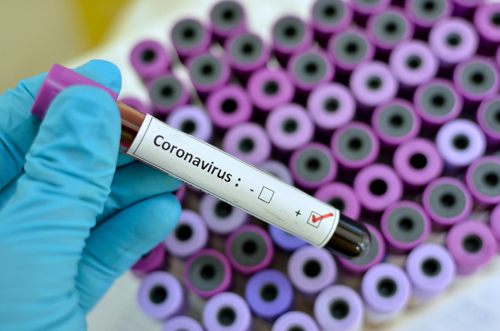     Emission spéciale Coronavirus : posez vos questions en direct sur RCI ce lundi


