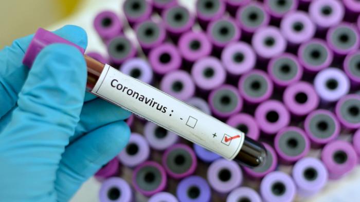     Coronavirus : 141 cas soit 2 de plus ce mercredi 

