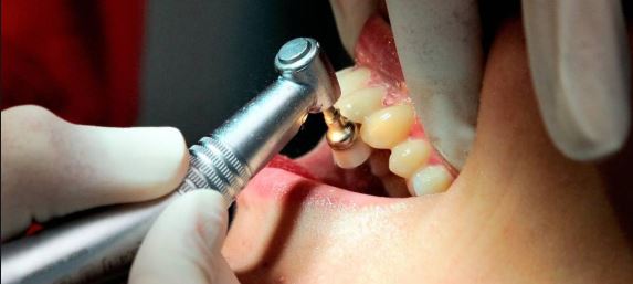     Les dentistes mettent en place une procédure pour gérer les gardes

